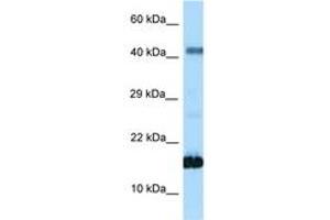 Image no. 1 for anti-Somatostatin (SST) (AA 35-84) antibody (ABIN6748033) (Somatostatin Antikörper  (AA 35-84))