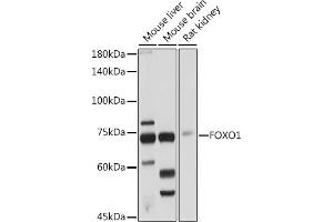 Western blot analysis of extracts of various cell lines, using FOXO1 antibody (ABIN3017007, ABIN3017008, ABIN3017009 and ABIN6219920) at 1:1000 dilution. (FOXO1 Antikörper)