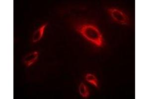Immunofluorescent analysis of TRAF2 staining in Hela cells. (TRAF2 Antikörper)