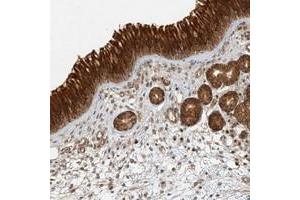 Immunohistochemical staining of human nasopharynx with KIAA0232 polyclonal antibody  shows strong cytoplasmic positivity in respiratory epithelial cells at 1:50-1:200 dilution. (KIAA0232 Antikörper)