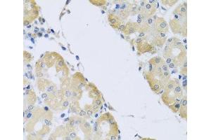 Immunohistochemistry of paraffin-embedded Human stomach using ATP2C1 Polyclonal Antibody at dilution of 1:100 (40x lens). (ATP2C1 Antikörper)