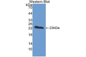Western Blotting (WB) image for anti-Fast Skeletal Troponin I (TNNI2) (AA 1-182) antibody (ABIN1860816) (TNNI2 Antikörper  (AA 1-182))