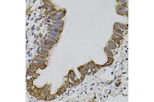 Immunohistochemistry of paraffin-embedded human lung using ARHGEF11 antibody. (ARHGEF11 Antikörper)