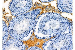 ABIN6261523 and ABIN6277133 at 1/100 staining Mouse testis tissue by IHC-P.