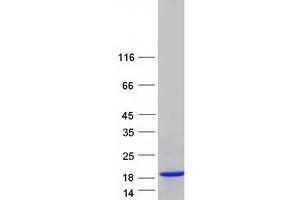 Western Blotting (WB) image for S100 Calcium Binding Protein A13 (S100A13) (Transcript Variant 5) protein (Myc-DYKDDDDK Tag) (ABIN2731297)