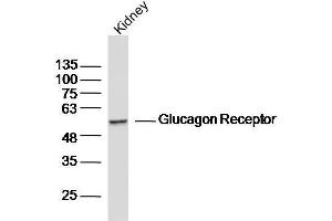 Mouse kidney lysates probed with Glucagon Receptor Polyclonal Antibody, unconjugated  at 1:300 overnight at 4°C followed by a conjugated secondary antibody for 60 minutes at 37°C. (Glucagon Receptor Antikörper  (AA 11-110))