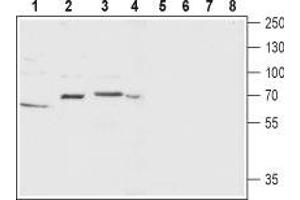 Western blot analysis of rat ovary (lanes 1 and 5), rat brain (lanes 2 and 6), mouse brain membrane (lanes 3 and 7) and SH-SY5Y (lanes 4 and 8) lysate: - 1-4. (TACR1 Antikörper  (2nd Extracellular Loop))