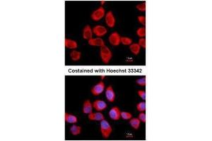 ICC/IF Image Immunofluorescence analysis of methanol-fixed A431, using RPLP2, antibody at 1:500 dilution. (RPLP2 Antikörper  (Center))