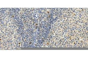 anti-Src Kinase Associated phosphoprotein 1 (SKAP1) (AA 163-189), (Middle Region) antibody