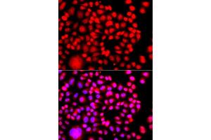 Immunofluorescence analysis of A549 cell using TESK2 antibody. (TESK2 Antikörper)