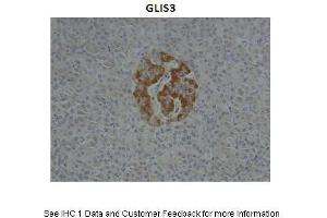 Sample Type :  Human Pancreas  Primary Antibody Dilution :  1:10  Secondary Antibody :  Anti-rabbit HRP  Secondary Antibody Dilution :  1:1000  Gene Name :  GLIS3  Submitted by :  Anonymous (GLIS3 Antikörper  (N-Term))