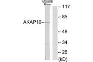 Western blot analysis of extracts from mouse brain cells, using AKAP10 Antibody. (AKAP10 Antikörper  (AA 10-59))
