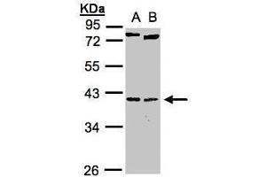 WB Image Sample(30 ug whole cell lysate) A:H1299 B:Raji , 10% SDS PAGE antibody diluted at 1:1000 (NK2 Homeobox 5 Antikörper)