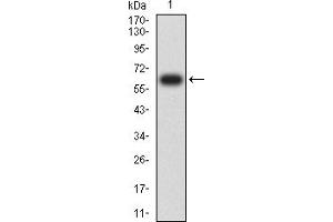 Western Blotting (WB) image for anti-Tumor Necrosis Factor Receptor Superfamily, Member 8 (TNFRSF8) (AA 19-379) antibody (ABIN7193372)