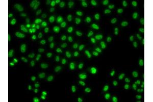 Immunofluorescence analysis of HeLa cells using LHX8 antibody (ABIN6293049).