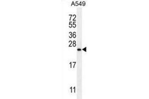 Western Blotting (WB) image for anti-Sorting Nexin 24 (SNX24) antibody (ABIN2996266) (SNX24 Antikörper)
