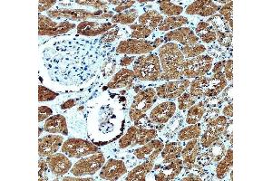 anti-Glutaredoxin 1 (GRX1) (AA 1-106) antibody