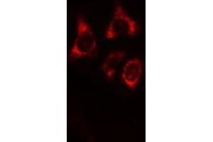 ABIN6269358 staining HeLa cells by IF/ICC. (IRF3 Antikörper  (C-Term))