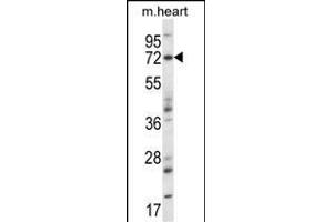 Mouse Map3k7 Antibody (N-term) (ABIN657840 and ABIN2846802) western blot analysis in mouse heart tissue lysates (35 μg/lane). (MAP3K7 Antikörper  (N-Term))
