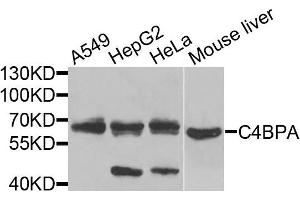 Western blot analysis of extracts of various cells, using C4BPA antibody. (C4BPA Antikörper)