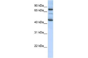 WB Suggested Anti-GAS2L1 Antibody Titration: 0. (GAS2L1 Antikörper  (Middle Region))