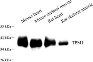 Western blot analysis of TPM1 (ABIN7076030),at dilution of 1: 400 (Tropomyosin Antikörper)