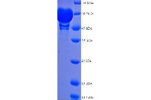 SDS-PAGE (SDS) image for Matrix Metallopeptidase 9 (Gelatinase B, 92kDa Gelatinase, 92kDa Type IV Collagenase) (MMP9) (AA 107-707) protein (His tag) (ABIN5713658)