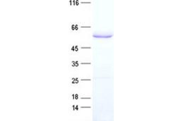 Keratin 77 Protein (KRT77) (His tag)