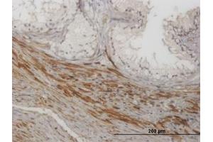 Image no. 1 for anti-NFKB Inhibitor Interacting Ras-Like 1 (NKIRAS1) (AA 1-101) antibody (ABIN599225) (NKIRAS1 Antikörper  (AA 1-101))