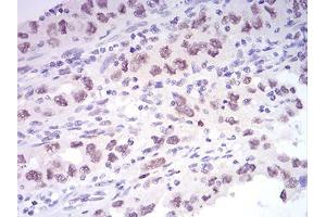 Immunohistochemistry (IHC) image for anti-Lysine (K)-Specific Demethylase 1A (KDM1A) (AA 55-263) antibody (ABIN5542574)