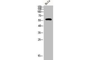Western Blot analysis of Hela cells using Phospho-PFK-2 car (S483) Polyclonal Antibody (PFKFB2 Antikörper  (pSer483))