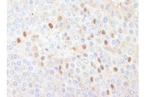 anti-Chromatin Licensing and DNA Replication Factor 1 (CDT1) (C-Term) antibody