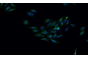 Detection of CTSK in Human HepG2 cell using Monoclonal Antibody to Cathepsin K (CTSK) (Cathepsin K Antikörper  (AA 115-329))