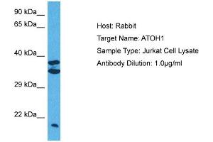 Host:  Rabbit  Target Name:  ATOH1  Sample Tissue:  Human Jurkat Whole Cell  Antibody Dilution:  1ug/ml (ATOH1 Antikörper  (Middle Region))