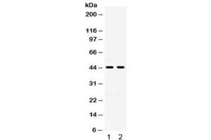 Western blot testing of 1) rat kidney and 2) human placenta lysate with HSD11B2 antibody.