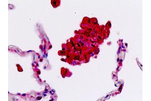 Anti-SELL / L-Selectin / CD62L antibody IHC staining of human lung, macrophages. (L-Selectin Antikörper  (AA 346-372))