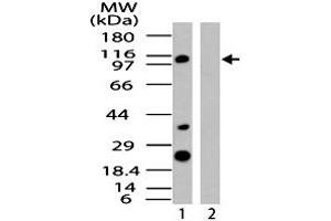 Western blot analysis of human IPO8 in HeLa cell lysate in the 1) absence and 2) presence of immunizing peptide. (Importin 8 Antikörper  (AA 850-900))