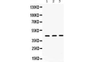 Western blot analysis of ORM1 expression in rat liver extract ( Lane 1), mouse liver extract ( Lane 2) and PANC whole cell lysates ( Lane 3). (ORM1 Antikörper  (AA 19-201))