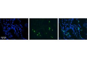 Rabbit Anti-RNASET2 Antibody     Formalin Fixed Paraffin Embedded Tissue: Human Lung Tissue  Observed Staining: Cytoplasmic in in alveolar cells, type I and II  Primary Antibody Concentration: 1:100  Other Working Concentrations: 1/600  Secondary Antibody: Donkey anti-Rabbit-Cy3  Secondary Antibody Concentration: 1:200  Magnification: 20X  Exposure Time: 0. (RNASET2 Antikörper  (Middle Region))