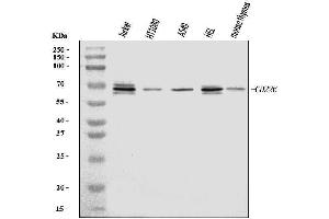 Western blot analysis of CD226 using anti-CD226 antibody (ABIN7600405).