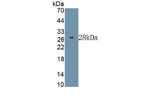 Detection of Recombinant ERK1, Human using Monoclonal Antibody to Extracellular Signal Regulated Kinase 1 (ERK1) (ERK1 Antikörper  (AA 75-312))