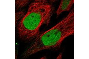 Immunofluorescent staining of human cell line U-2 OS with KIF4A polyclonal antibody  at 1-4 ug/mL dilution shows positivity in nucleus.