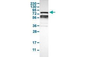 Western Blot analysis of human cell line RT-4 with RIPK1 polyclonal antibody . (RIPK1 Antikörper  (AA 306-449))