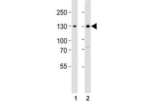 Western blot analysis of lysate from (1) 293 and (2) Jurkat cell line using GLI2 antibody at 1:1000. (GLI2 Antikörper  (C-Term))