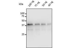 Anti-Pepsin Ab at 1/500 dilution, 40-100 ng of Pepsin isolated from porcine gastric mucosa, rabbit polyclonal to goat lgG (HRP) at 1/10,000 dilution, (Pepsin Antikörper)