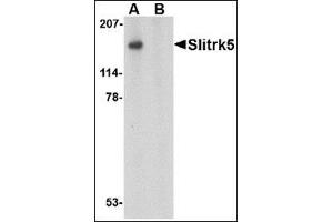 Western blot analysis of Slitrk4 in mouse brain tissue lysate with this product at (A) 0. (SLITRK5 Antikörper  (Center))