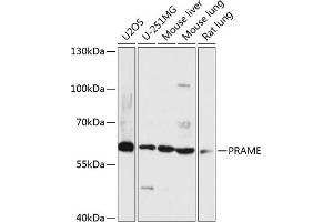 Western blot analysis of extracts of various cell lines, using PRAME antibody (ABIN7269507) at 1:3000 dilution. (PRAME Antikörper  (AA 1-200))