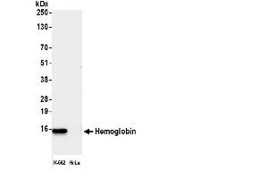 Western Blotting (WB) image for anti-Hemoglobin antibody (ABIN7449296)
