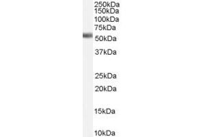 Western Blotting (WB) image for anti-Nuclear Receptor Subfamily 1, Group H, Member 4 (NR1H4) (Internal Region) antibody (ABIN334396)