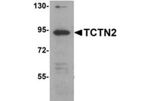 Western blot analysis of TCTN2 in SK-N-SH cell lysate with TCTN2 antibody at 1 μg/ml. (TCTN2 Antikörper  (C-Term))
